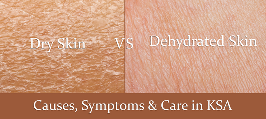 Dry vs Dehydrated Skin: Causes, Symptoms & Care in KSA
