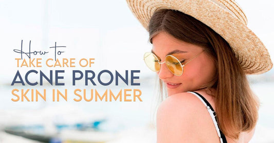 How to Take Care of Acne Prone Skin in Summer