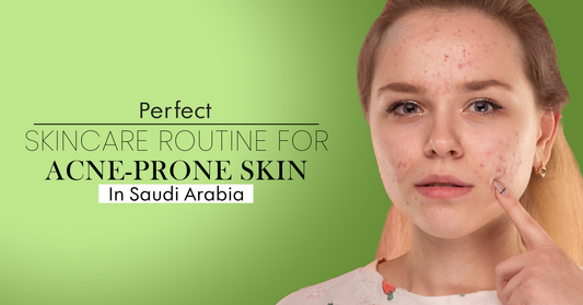 Perfect Skincare Routine for Acne-Prone Skin in Saudi Arabia